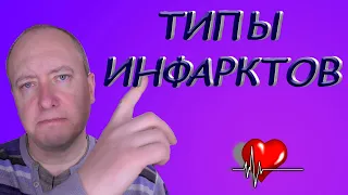 Типы инфарктов (микроинфаркт и обширный инфаркт)