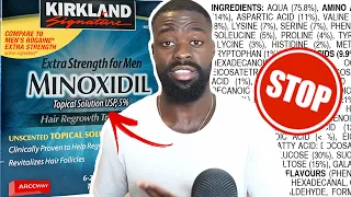 Why I STOPPED USING Minoxidil to Improve my Beard Growth - Don't use Minoxidil Before Watching This!