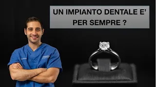 Quanto dura un impianto dentale?