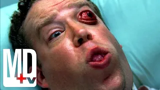 Patient's Eye Bursts Out of Head | House M.D. | MD TV