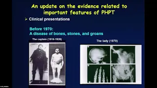 Update on Primary Hyperparathyroidism - Dr. John Bilezikian