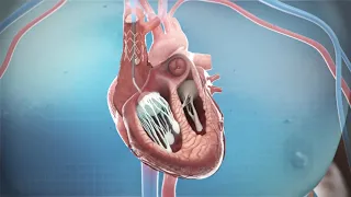 CroiValve MOA Animation