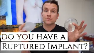 How To Know If You Have a Ruptured Implant | Dr. Daniel Barrett | Los Angeles