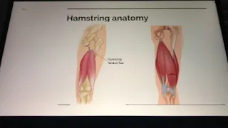 Hamstring Injury