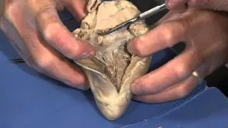 Detailed Sheep Heart Dissection: Part II (Jr. High, High School and College Review)