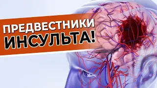 Первые признаки ИНСУЛЬТА! Лучше предупредить, чем лечить! Упражнение для профилактики