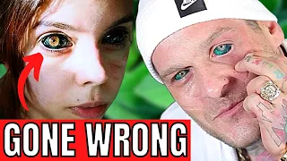 6 People Who Went Blind Getting Eyeball Tattoo (Eyeball Tattoos Gone Wrong)