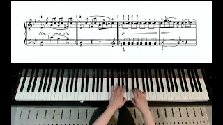 Sweet Sorrow Op. 100 No. 16 By Johann Friedrich Burgmüller - RCM Level 5