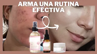 ✨ Rutina Facial PASO a PASO Skincare Barato para ACNÉ, PIEL GRASA, SECA + Productos que NO Necesitas