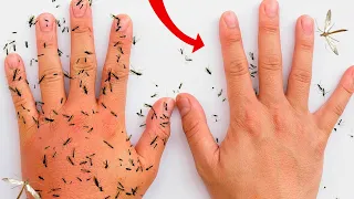 Por qué te Pican LOS MOSQUITOS y Cómo Solucionarlo