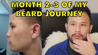 Minoxidil Beard | Month 2 and 3 of my Beard Journey