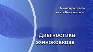 Диагностика эхинококкоза