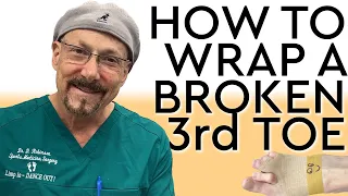 How To Wrap A Broken 3rd Toe