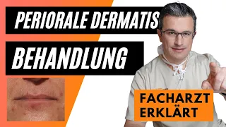 Periorale Dermatitis: Behandlung, Pflege, Make up, Nulltherapie #perioraledermatitisbehandlung