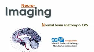 Imaging of traumatic brain injury - Prof. Mamdouh Mahfouz
