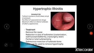 Acute and Chronic Rhinitis