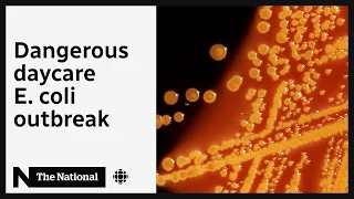 Daycare E. coli outbreak: Why are children getting so sick?