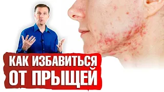 Как избавиться от прыщей?