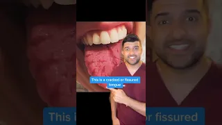 Does Your Tongue Look Weird? 👅 Dentist Explains What Could Be Wrong…