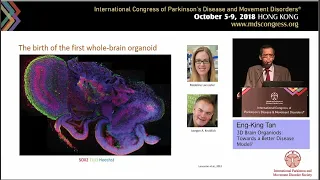 2018 MDS Presidential Lecture - 3D Human Brain Organoids: Towards a Better Disease Mode