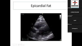 20230305, 46th course online, pericardium