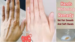 Do This Every Night For 3 Days To Lighten Dark Knuckles And Brighten Hands & Feet (MA)