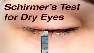 Schirmer's Test for Dry Eyes