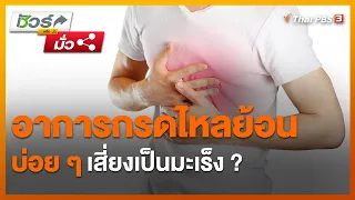 คนที่มีอาการกรดไหลย้อนบ่อย ๆ เสี่ยงเป็นมะเร็ง ? : ชัวร์หรือมั่ว (2 มิ.ย. 64)