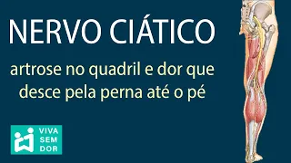 Nervo ciático, artrose no quadril e dor que desce pela perna até o pé