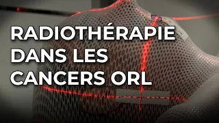 Radiothérapie dans la prise en charge des cancers ORL