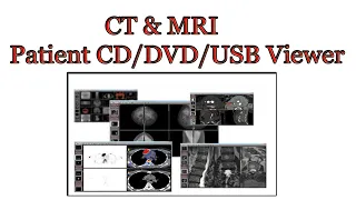 CT & MRI patient CD/DVD/USB viewer