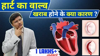 Heart Valvular Regurgitation, Symptoms, Surgery Recommendation