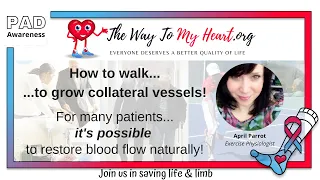 Peripheral Artery Disease: How To Grow Collateral Vessels by Walking