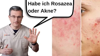 5 WICHTIGE Unterschiede zwischen Akne und Rosazea (Hautarzt erklärt). Dr. Kasten Hautmedizin, Mainz