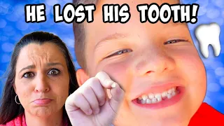 CALEB LOST his FIRST TOOTH!