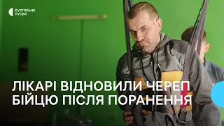 "Усміхається, коли на себе дивиться": бійцю з Волині лікарі відновили череп після поранення