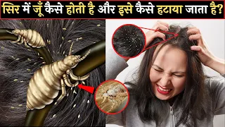 जानिए सिर में जूँ कैसे होती है और इसे कैसे हटाया जाता है? | How to remove lice from hair | facts