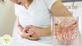 TRATAMENTO DA DOENÇA DE CROHN | APRENDA NUTRIÇÃO