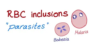 RBC inclusions (Parasites; malaria and babesia)