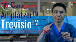 Amplatzer Trevisio Intravascular Delivery System: Great Innovation?