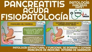 PANCREATITIS AGUDA FISIOPATOLOGÍA | GuiaMed