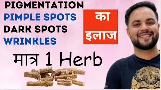 मात्र 1 Herb से Pigmentation, Pimple Spots, Dark Spots & Wrinkles का इलाज