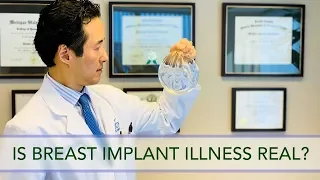 Are Breast Implants Safe? Is Breast Implant Illness Real?