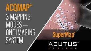 Acutus Mapping Modality — SuperMap™