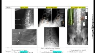 مراجعة سريعة لشرح جميع الأشعة Rapid Radiological Revision د. محمود سويلم