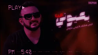 قيس هشام _ بعيوني اضمه + معزوفة ( ريمكس دي جي علوش ) REMIX BY DJ ALLOUSH 2022