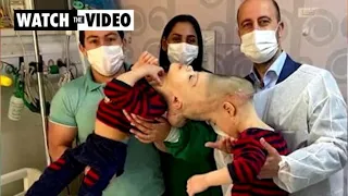 Rare conjoined twins connected at the head separated in Brazil