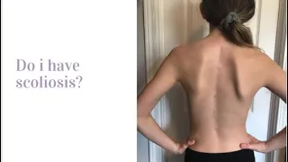 My Most Frequently Asked Questions About My Scoliosis