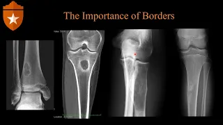 Basics of Bone Imaging