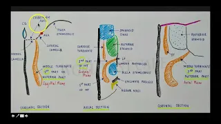 Attachments of the Middle Turbinate - Educational Video by Dr. Shyam Kalyan N, World ENT Care